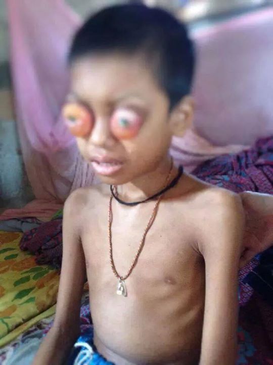 ท้าวแร่ เด็กชายชาวลาว