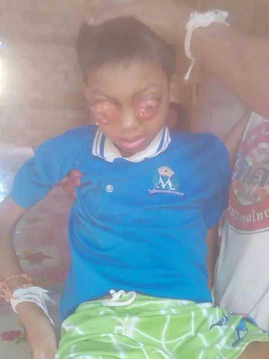 ท้าวแร่ เด็กชายชาวลาว