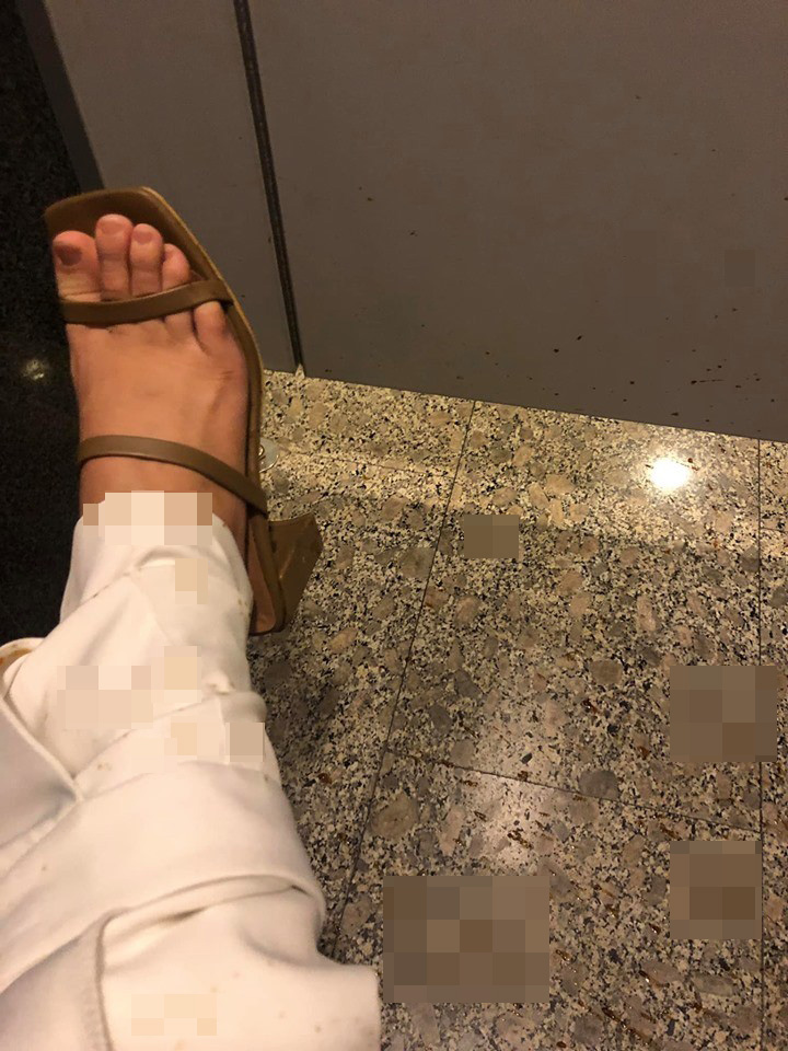 สาวเข้าห้องน้ำแล้วโดนขี้แตกกระเด็นใส่ขา