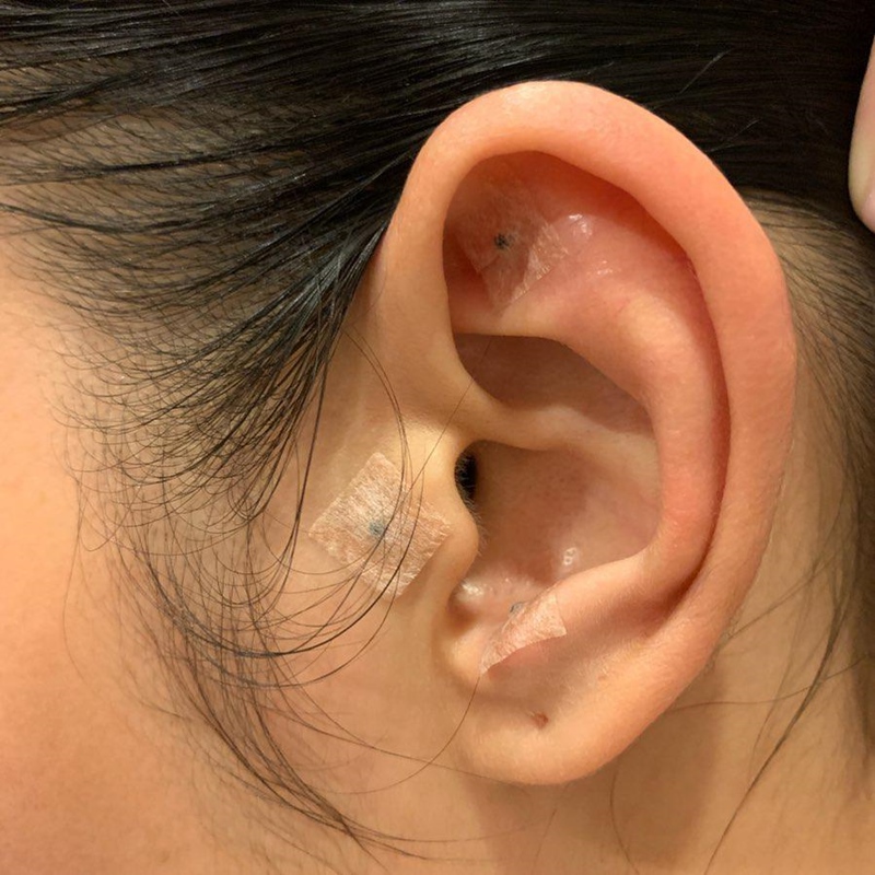 ตั๊ก บงกช เมล็ดผักกาดลดน้ำหนัก