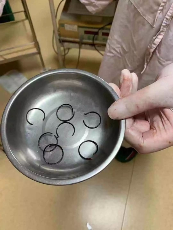 คุมกำเนิดผิดวิธี