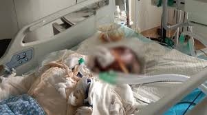 ป๊อปคอร์นระเบิด