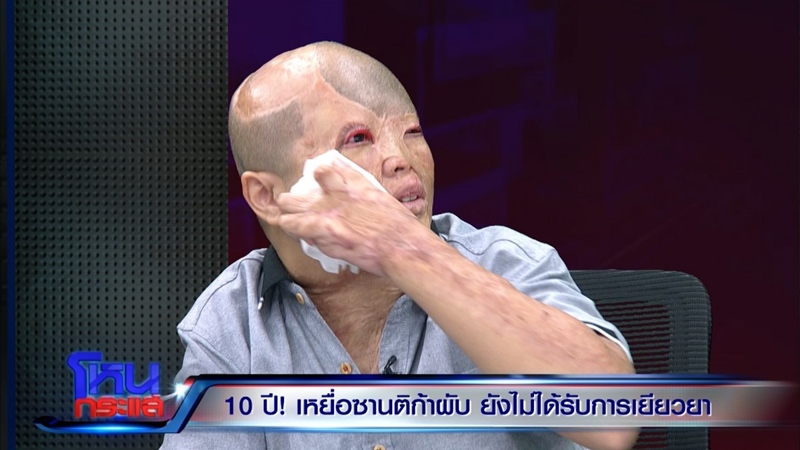 เปิดใจเหยื่อไฟไหม้ซานติก้าผับ