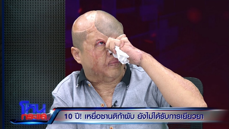 เปิดใจเหยื่อไฟไหม้ซานติก้าผับ