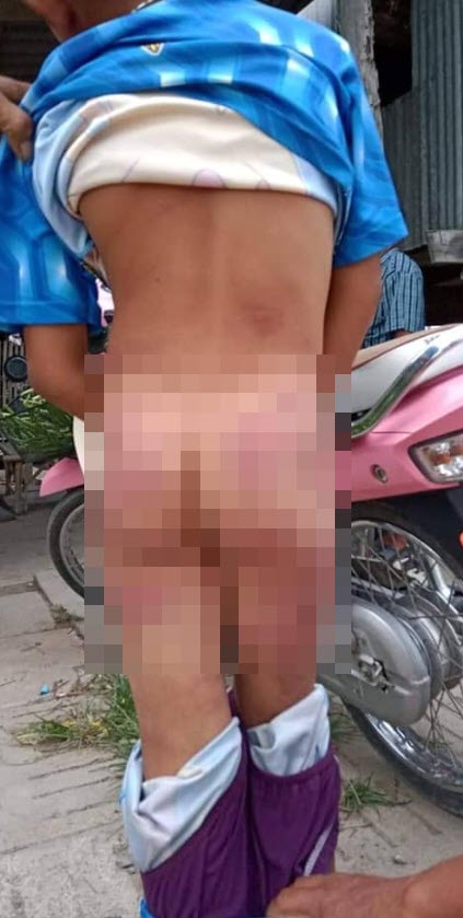 ครูตีเด็ก