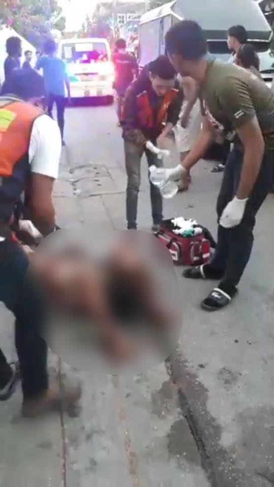 ทอมหึงโหด เผาแฟนทั้งเป็น