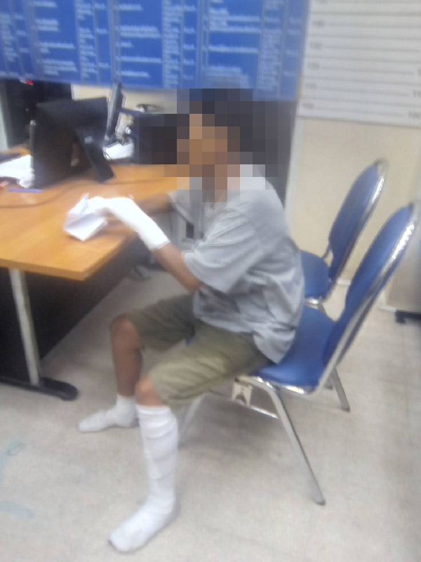 ทอมหึงโหด เผาแฟนทั้งเป็น