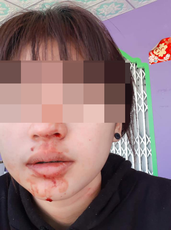 ทำร้ายร่างกายแฟน