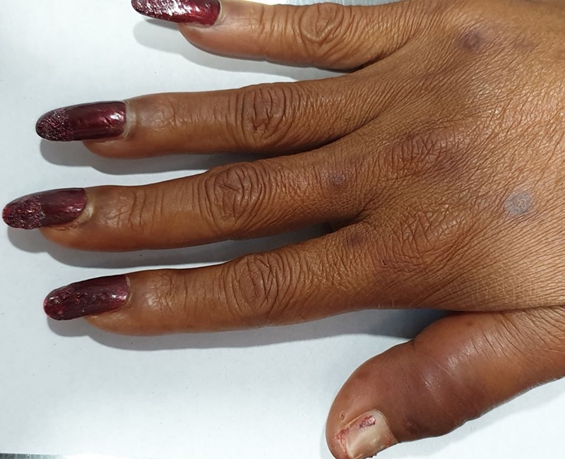 ทำเล็บแฟชั่นเสี่ยงติดเชื้อ