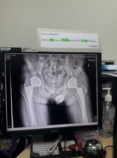 การวิ่งไม่ได้รักษาทุกโรค