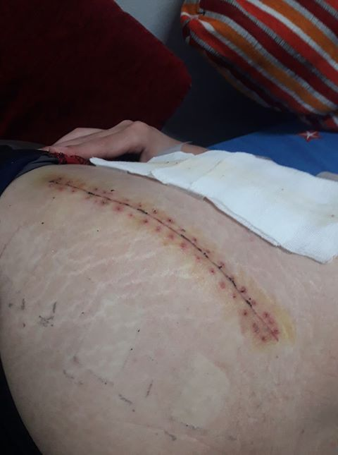 การวิ่งไม่ได้รักษาทุกโรค