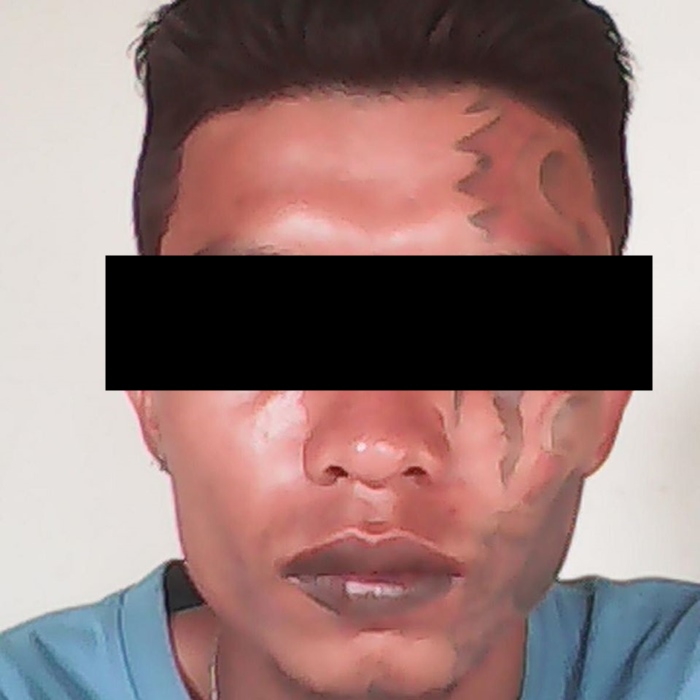 หนุ่ย หน้าลาย