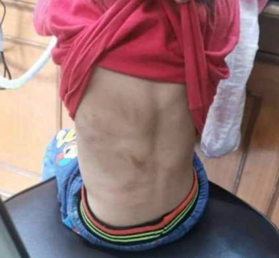 เด็กถูกทิ้ง