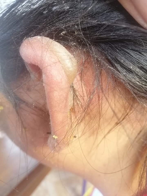 เด็ก ม.3 สาดน้ำร้อนใส่หน้าเด็ก ม.1