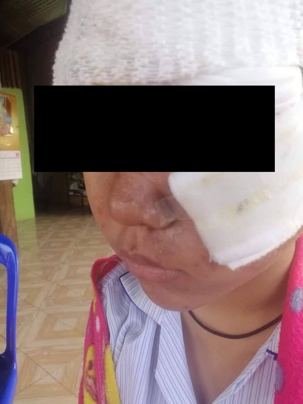 เด็ก ม.3 สาดน้ำร้อนใส่หน้าเด็ก ม.1