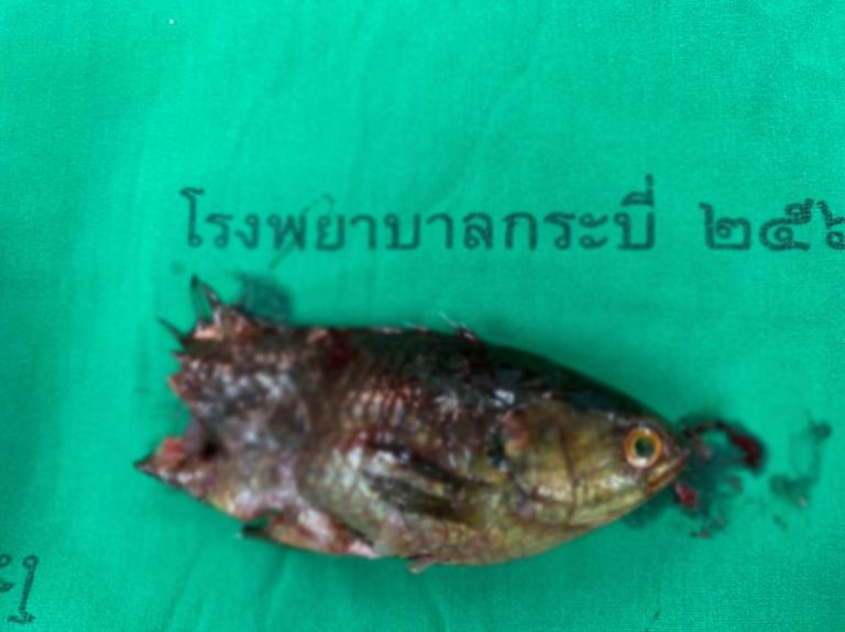 ปลาหมอติดคอ