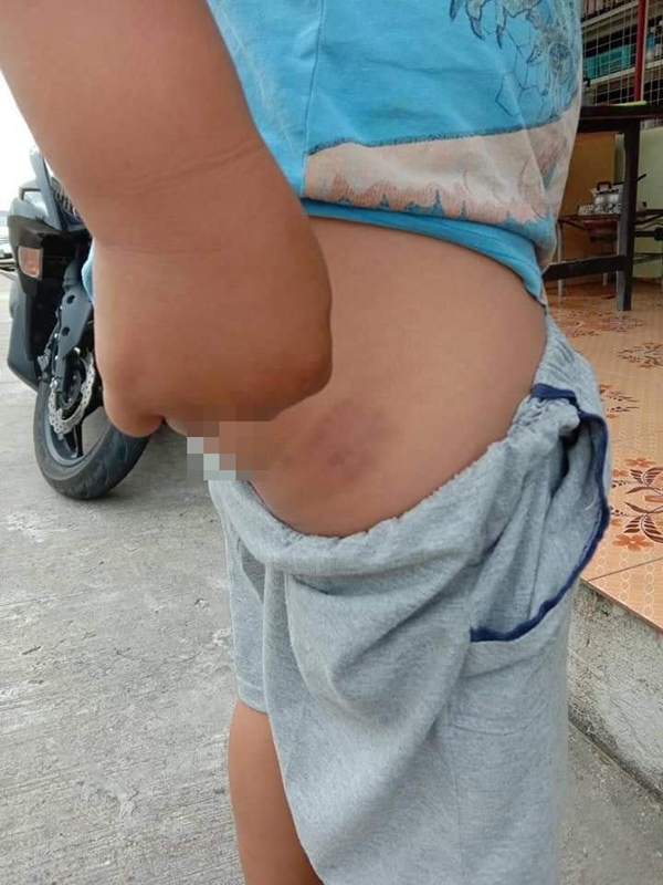 ครูตีนักเรียน