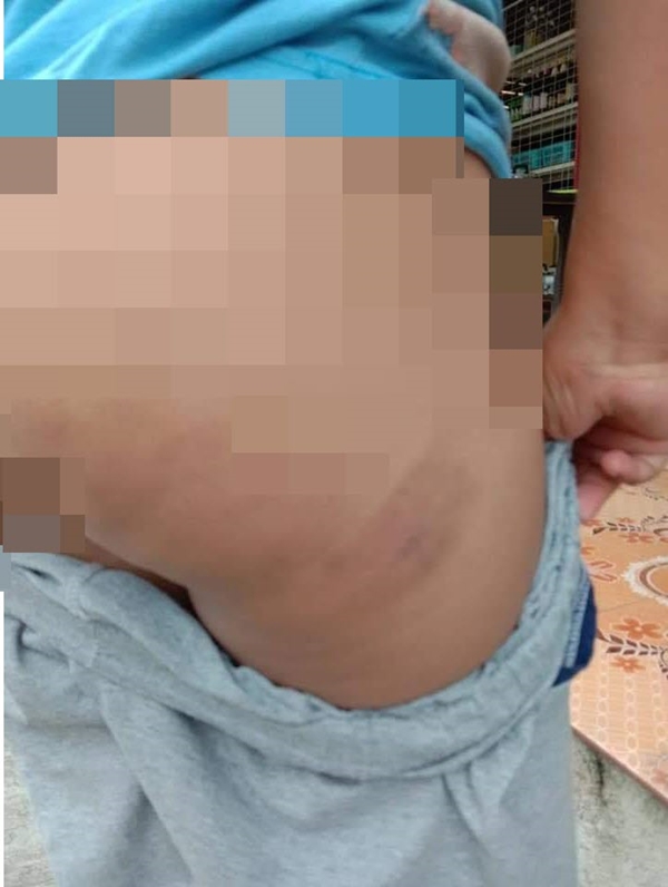 ครูตีนักเรียน