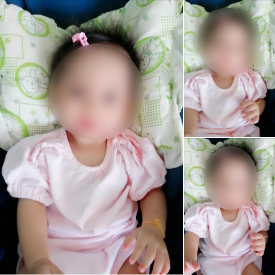 เด็กเสียชีวิตจากไวรัส RSV 