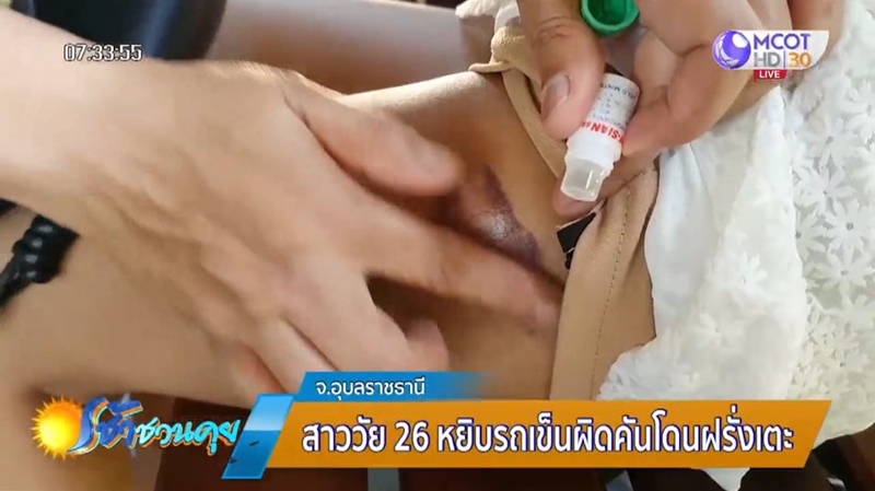 ฝรั่งทำร้ายสาวไทย