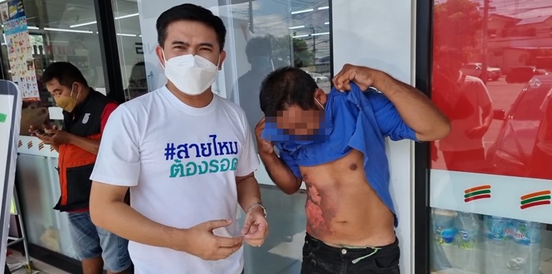 สาดน้ำร้อนคนเร่ร่อน