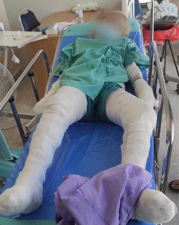 ข่าวเด็กรัสเซียตกบ่อน้ำพุร้อน