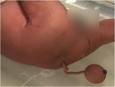 ทารกมีหาง