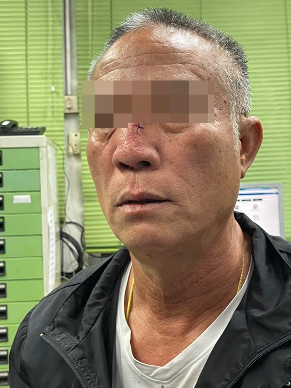 ตำรวจถูกต่อย