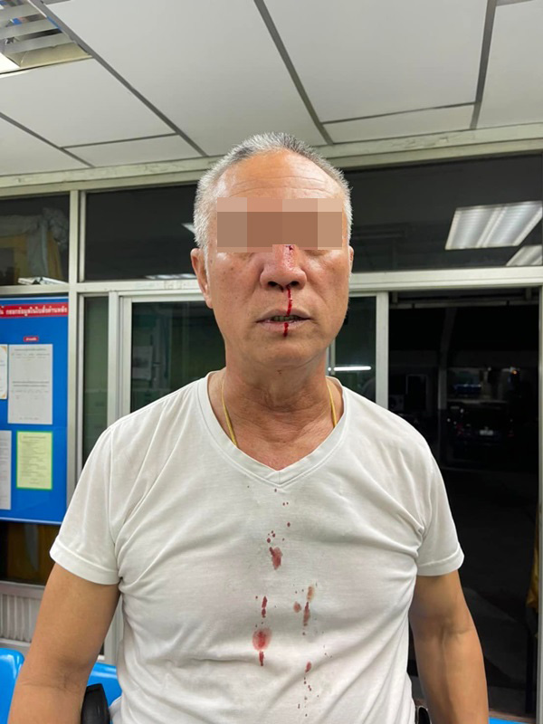 ตำรวจถูกต่อย