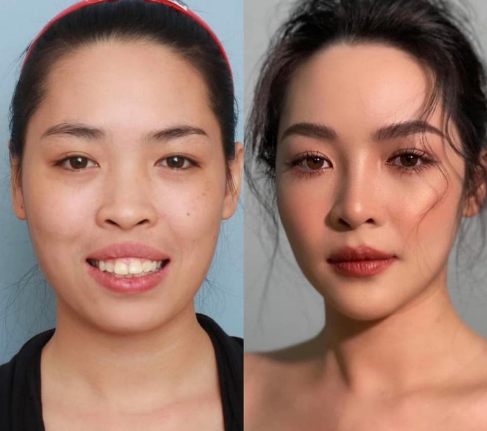 ศัลยกรรม