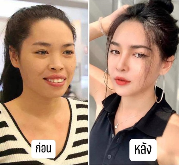 ศัลยกรรม