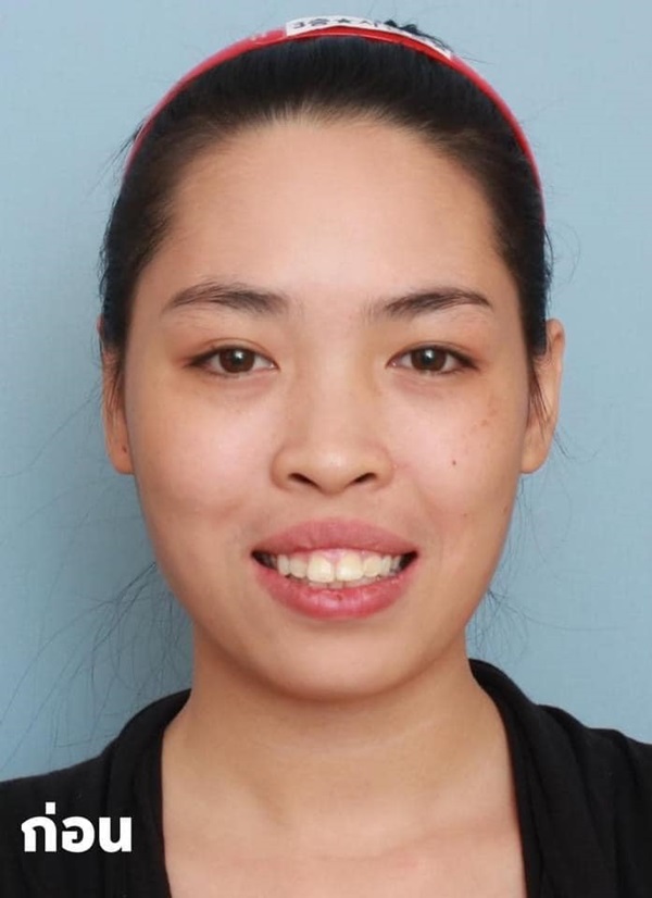 ศัลยกรรม