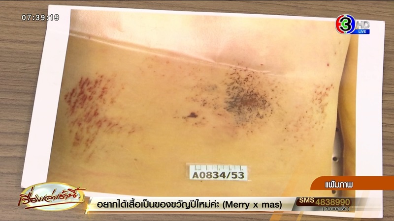 คดีหมอศรุต