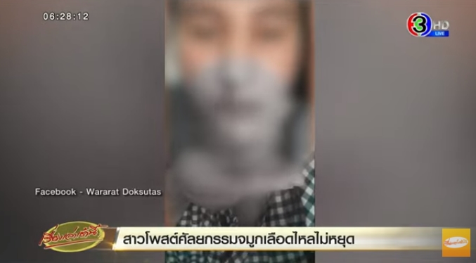 ศัลยกรรมจมูกพลาด