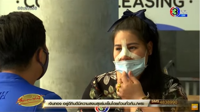 ศัลยกรรมจมูกพลาด