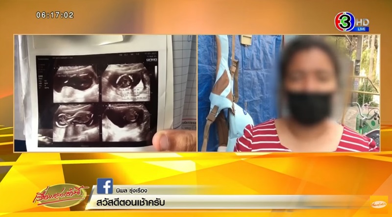 ทำแท้งแต่เด็กยังอยู่ในท้อง