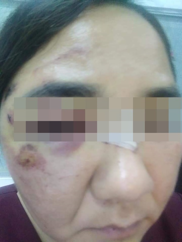 ผอ. ต่อยครู