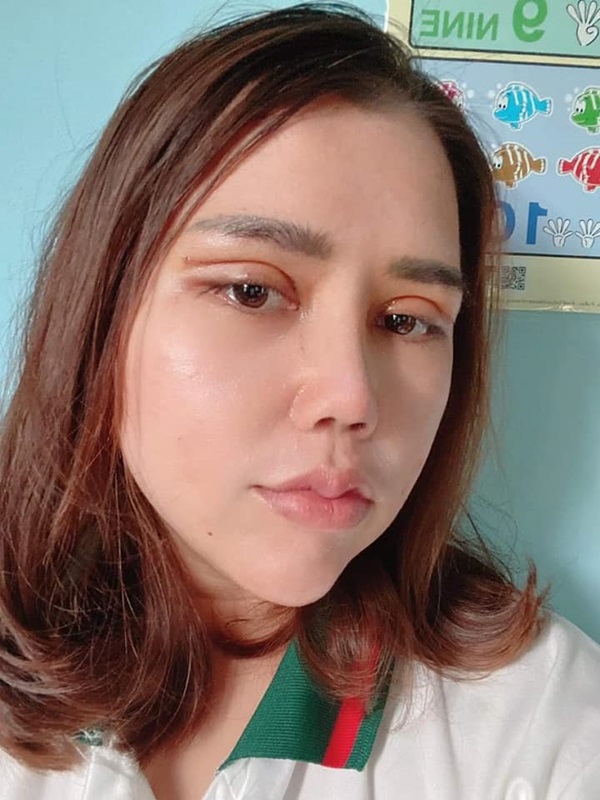 เมียหลวงบุกงานแต่ง ศัลยกรรม