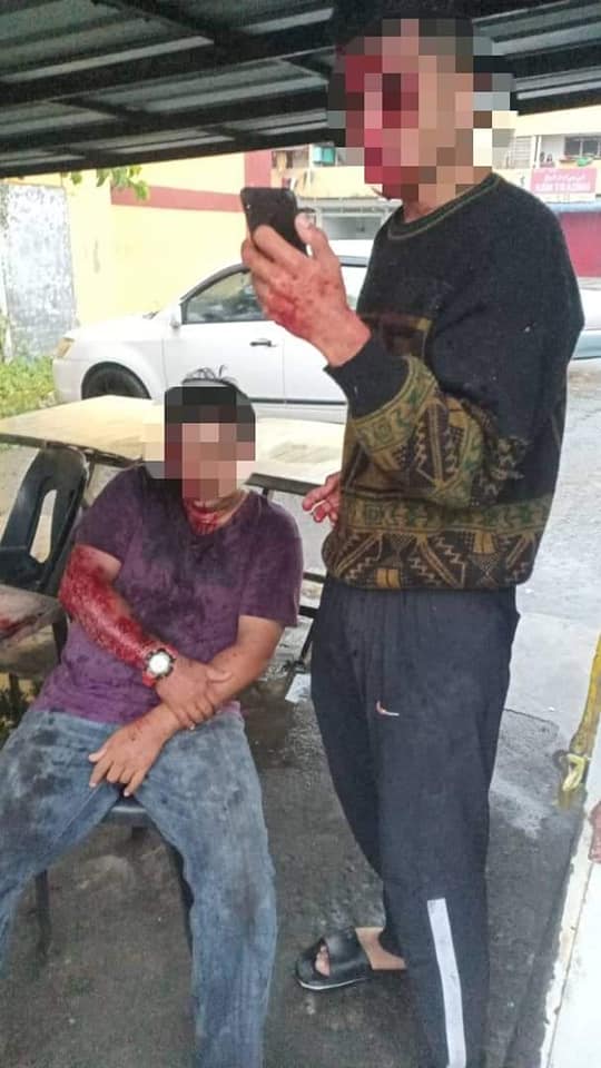 ฟ้าผ่ารถ