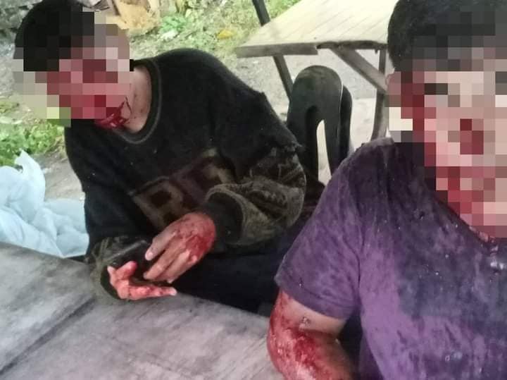 ฟ้าผ่ารถ