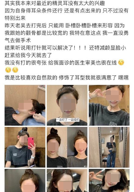 ศัลยกรรมหูเอลฟ์