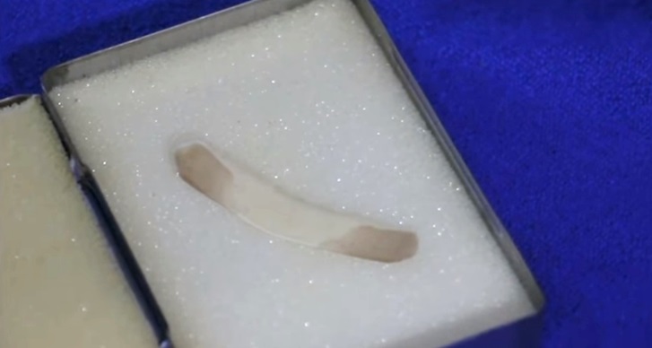 เกล็ดพญานาค