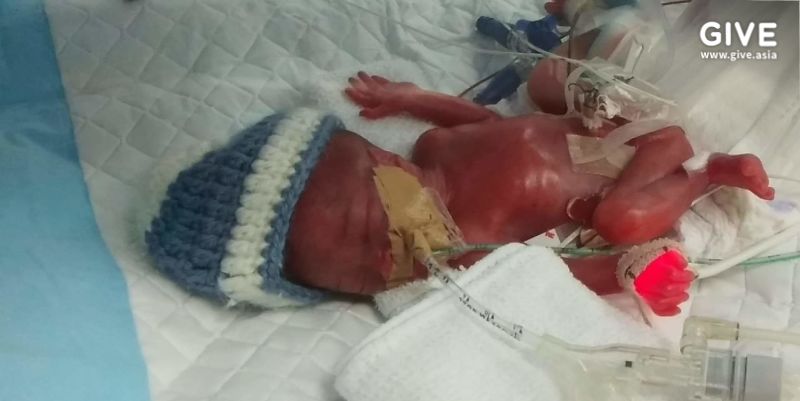 ทารกตัวเล็ก หนัก 2 ขีด