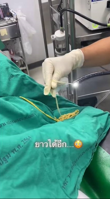 ดึงพยาธิออกจากปากคนไข้