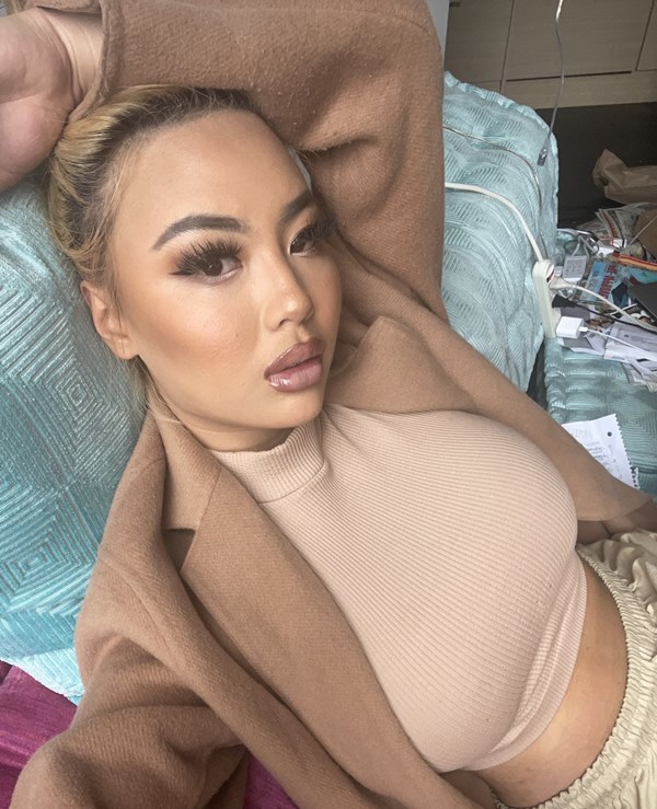 คาซูมิ สเควิตส์