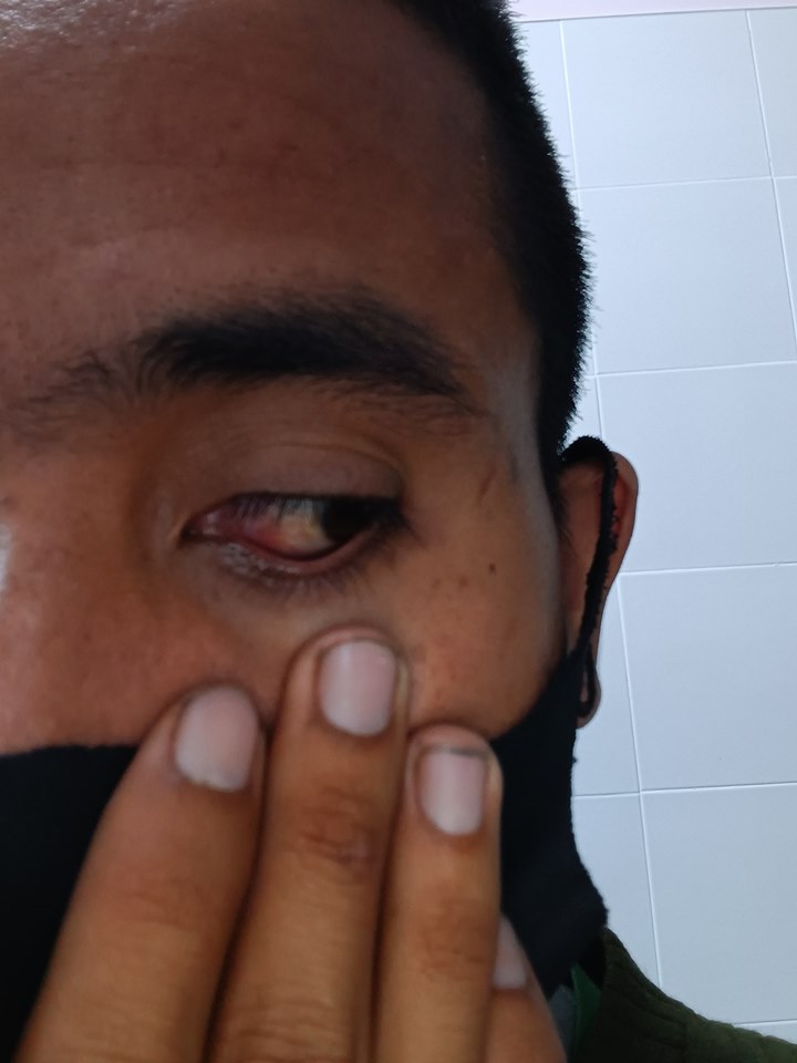 ไฟประดับฟาดตา