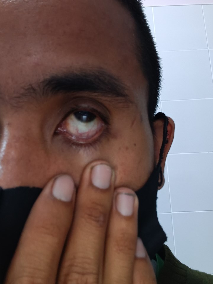 ไฟประดับฟาดตา