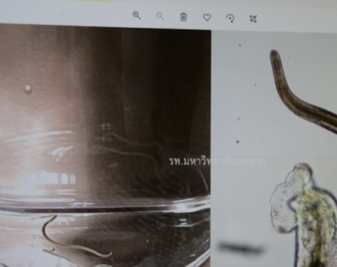 พยาธิไชขึ้นตา