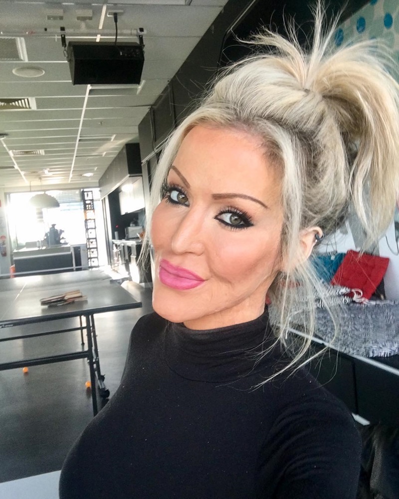 สาวโดนเผาร่าง