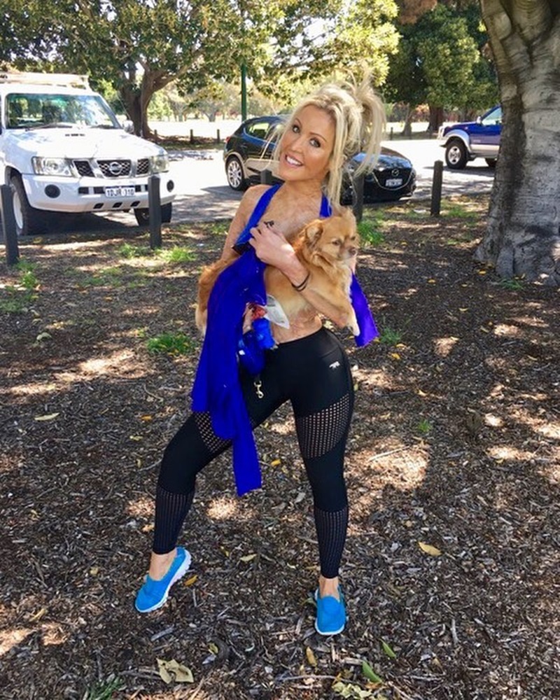 สาวโดนเผาร่าง